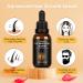 5% Minoxidil Hair Growth Serum with Biotin - 1 fl.oz - Men & Women Hair Regrowth Treatment - Buy Online on GoSupps.com