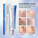 Advanced Scar Removal Cream for Face & Body - Effective Treatment for Keloids C-Section Surgery Burns & Acne - 30g/1.06 fl oz - Buy Online on GoSupps.com
