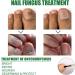 Antifungal Nail Treatment for Toe Fungus - 2-in-1 Solution to Treat and Prevent Nail Fungal Infections - Buy Online on GoSupps.com