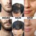 Beard Kit - Derma Roller for Facial Hair Growth & Skin Care | 0.25mm Beard Care Tools - Buy Online on GoSupps.com
