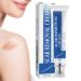 Anti-Scars Cream | 30g Repair Product Repairing Cream for Old Scars For Recovery Wound Cheloids Women Men Athletes