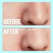 Peace Out Pores Hydrocolloid Nose & Face Strips with Vitamin A - Enlarged Pore Refining & Oil Control (4 Pore & 4 Nose Strips) - Buy Online on GoSupps.com