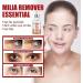 Milia S rum d maquillant pour le contour des yeux S rum facial contre les miliums et les taches brunes pour homme et femme r duit le rel chement de la peau les gonflements et les ridules 30 ml 1 pi ce. - Buy Online on GoSupps.com