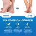 Callus Remover for Feet Extra Strength with Stainless Steel Foot File (Pedicure Grade) - Professional Foot Rasp Callus Remover Softener - Callus Treatment Heels and Hands - Cuticle Remover & Softener - Buy Online on GoSupps.com