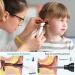 ScopeAround Wireless Otoscope Ear Camera Kit - 3.9mm Visual Scope for Ear Wax Removal - 6 LED Lights - Android/iPhone/iPad Compatible - White - Buy Online on GoSupps.com