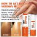 Fashion Base Ingrown Hair Treatment Roll-On - Reduce Razor Bumps and Ingrown Hairs - Soothing Serum for Ingrow Solutions - After Shave Ingrown Hair Reduction - Buy Online on GoSupps.com