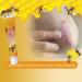 XRCZYM Bee Psoriasis Treatment Cream - Soothing & Moisturizing Professional Formula from New Zealand (3pcs) - Buy Online on GoSupps.com