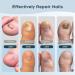 Berrlly Nail Fungus Laser Device | Effective Treatment for Fingernails & Toenails | Easy-to-Use & Foldable Solution for Discolored & Thickened Nails - Buy Online on GoSupps.com