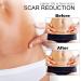 XIRENE 6-Pack Medical Grade Silicone Scar Sheets for Old & New Scars - Reusable & Washable Scar Removal Strips for Acne, C-Section, Keloid, Surgery & Burn - Buy Online on GoSupps.com