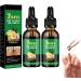 Essence de soin des ongles au gingembre stoppe rapidement la propagation des champignons et les limine r pare les ongles ab m s rend vos ongles naturellement brillants 2 Pcs