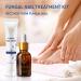 Natural Heals Nail Fungus Treatment Kit - Liquid & Cream for Healthy Toenails | Repair Fungal Infections, Stop Fungus Growth, Extra Strength Formula - Buy Online on GoSupps.com