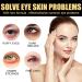 C lyn Instant Firmx Eye Tightener | Reduce Eye Bags & Puffiness | Anti-Aging Eye Cream for All Skin Types (2PCs) - Best International Shipping - Buy Online on GoSupps.com