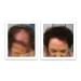 Caboki Hair Loss Concealer - All-Natural Hair Building Fibers - Travel Size, Dark Brown - Buy Online on GoSupps.com