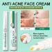 Anti-Acne Face Cream Spot Cream for Acne Treatment and Spot Treatment Skin Treatment Gel Cream For Face Blemishes & Blackheads Acne Treatment Cream Anti Acne Spot - Buy Online on GoSupps.com