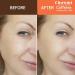 Caffeine Solution 5% + EGCG - Best Under Eye Serum for Puffiness & Pigmentation | 30ml Moisturizing Eye Contour Treatment - International Shipping Available - Buy Online on GoSupps.com