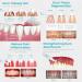 Lovilds Zefux Neslemy Dentiz & Fivfivgo Gum Therapy Gel | 2PCs for Optimal Gum Health | International Shipping - Buy Online on GoSupps.com