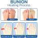iKneonei Projoint Antibunions Health Socks - 5 Pairs | Toe Spreaders & Bunion Corrector for Women - Buy Online on GoSupps.com
