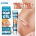 Scar Gel 20 G Effective in Treating Scars C-Section Scars Stretch Marks Acne Surgery Burns Effective On Old and New Scars - Buy Online on GoSupps.com