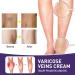 Varicose Veins Cream Spider Vein Cream Varicose Veins Relief Cream Spider Veins Repair Cream Varicose Veins Treatment for Legs Vein Cream for Legs Aching Legs Relief Cream for Varicose Veins in Legs - Buy Online on GoSupps.com