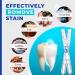 Luelli Professional Teeth Whitening Pen - 4 Gel Pens, 35% Carbamide Peroxide, Sensitive Teeth - Home Dental Care - Buy Online on GoSupps.com