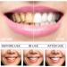 Teeth Whitening Abbey - 2-Piece Whitening Pen Set | Effective Stain Removal & Brightening Gel for White Teeth - Buy Online on GoSupps.com