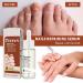 7 Days Nail Growth & Strengthening Serum - Nail Serum for Thin Nails - 1 pcs - Buy Online on GoSupps.com