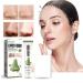 Green Tea Blackhead Remover & Charcoal Peel Off Mask | Deep Cleaning Pore Cream for All Skin Types | Oil Control & Purifying Skin Care - Buy Online on GoSupps.com