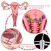 Vaginal Cleaning Syringe | Reusable Manual Pressure Cleaner Kit with 3 Nozzles - 600ml Capacity for Personal Hygiene - Buy Online on GoSupps.com