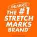 Mederma Stretch Marks Therapy Helps Prevent and Treat Stretch Marks Safe to Use When Pregnant & Palmer's Cocoa Butter Formula Massage Lotion for Stretch Marks Pregnancy Skin Care Belly Cream - Buy Online on GoSupps.com