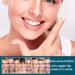 Adjustable Snap-On Prostheses & Artificial Teeth for Men & Women | 3-Piece Veneers for a Confident Smile - Buy Online on GoSupps.com