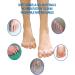 WenTigDY Bunion Corrector Toe Separators - Toe Straightener and Spacer for Men and Women - Restore Toes to Original Shape - White - Buy Online on GoSupps.com