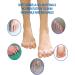 Bunion Corrector Toe Separators - Restore Toes' Shape and Correct Bunions (Blue) - Buy Online on GoSupps.com