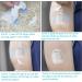 LiangMai Pack of 40 Waterproof Omnipod Adhesive Patches - Transparent, Breathable, Skin-Friendly, Self-Adhesive Patch for Omnipod - Durable up to 10 Days - Buy Online on GoSupps.com