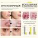 Skincare Set for Acne Prone Skin Anti Acne Skin Care Sets & Kits Skincare Gift Set with Cleanser- Serum- Essence Gel- Mask*2 Acne Remove Oil Control Facial Kit Hydrate Shrink Pore Sooth Redness - Buy Online on GoSupps.com