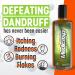 Medicasp Coal Tar Gel Dandruff Shampoo for Seborrheic Dermatitis & Psoriasis (6oz, Pack of 2) - Buy Online on GoSupps.com