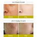 Essenz l Repair Facial Essence Oil - Non-Fat Turmeric Oil for Skin Face & Body | Natural Essential Oil for Massage & Home Comfort - Buy Online on GoSupps.com