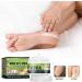 42% Urea Cream with 2% Salicylic Acid Urea Hand Cream for Dry Cracked Skin Repairs Rough Feet & Hands Moisturizes with Coconut & Aloe 50g - Buy Online on GoSupps.com