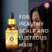 Deve Herbes Huile de vitamine E naturelle de qualit th rapeutique (lot de 2) (30 ml + 30 ml) - Buy Online on GoSupps.com