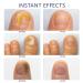 Extra Strength Toe Nail Fungus Treatment - Nail Repair Solution for Damaged Nails - Buy Online on GoSupps.com