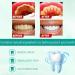 Bright Whitening Teeth Mousse - Herbal Oral Repair for Fresh Breath & Gum Health | Deep Cleaning Toothpaste (1PC) - Buy Online on GoSupps.com