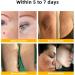 ZVLZVL Bee Venom Professional Treatment Cream - 2024 Hydrating & Moisturizing Repair Cream for Men & Women (1 Fl Oz) - International Shipping Available - Buy Online on GoSupps.com