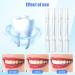 4 Teeth Whitening Pens - Fast & Gentle Tooth Whitening Solution | Gentle Bleaching for a Bright Smile - Buy Online on GoSupps.com