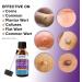 Pureskin Extra Strength Liquid Corn Remover for Toes and Feet - Callus Removal Treatment - Buy Online on GoSupps.com