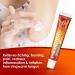 Itching Cream for Minor Irritations | Soothes and Restores Irritated Skin | Health Care for Men and Women - Buy Online on GoSupps.com