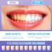 Kit de blanchiment dentaire 3 Pi ce stylos de Blanchiment Dents Blanchir les Dent Facilement Set professionnel gel claircissant pour un sourire plus blanc la maison - Buy Online on GoSupps.com
