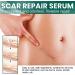 BLEDD Scarrevita Advanced Repair Serum - Advanced Scar Gel Serum - Buy Online on GoSupps.com