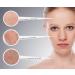 Floslek Fruit Acid Peeling - 125g AHA Face Mask for All Skin Types | Effective Gommage for Mess Pimples & Pustules | International Shipping Available - Buy Online on GoSupps.com