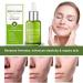 Goopgen Advanced Scar Repair Serum - Nature Scar Treatment for Acne, Surgical Scars, and Stretch Marks (1pcs) - Buy Online on GoSupps.com