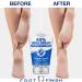 LOVE LORI Urea Cream 40% for Cracked Heel Repair (4oz) - Intensive Foot Repair & Callus Remover - Hydrating Foot Lotion - Buy Online on GoSupps.com