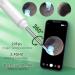 VITCOCO Wireless Ear Wax Removal Kit 1920P Camera with 6 LED Lights for iPhone Android iPad - White - Buy Online on GoSupps.com